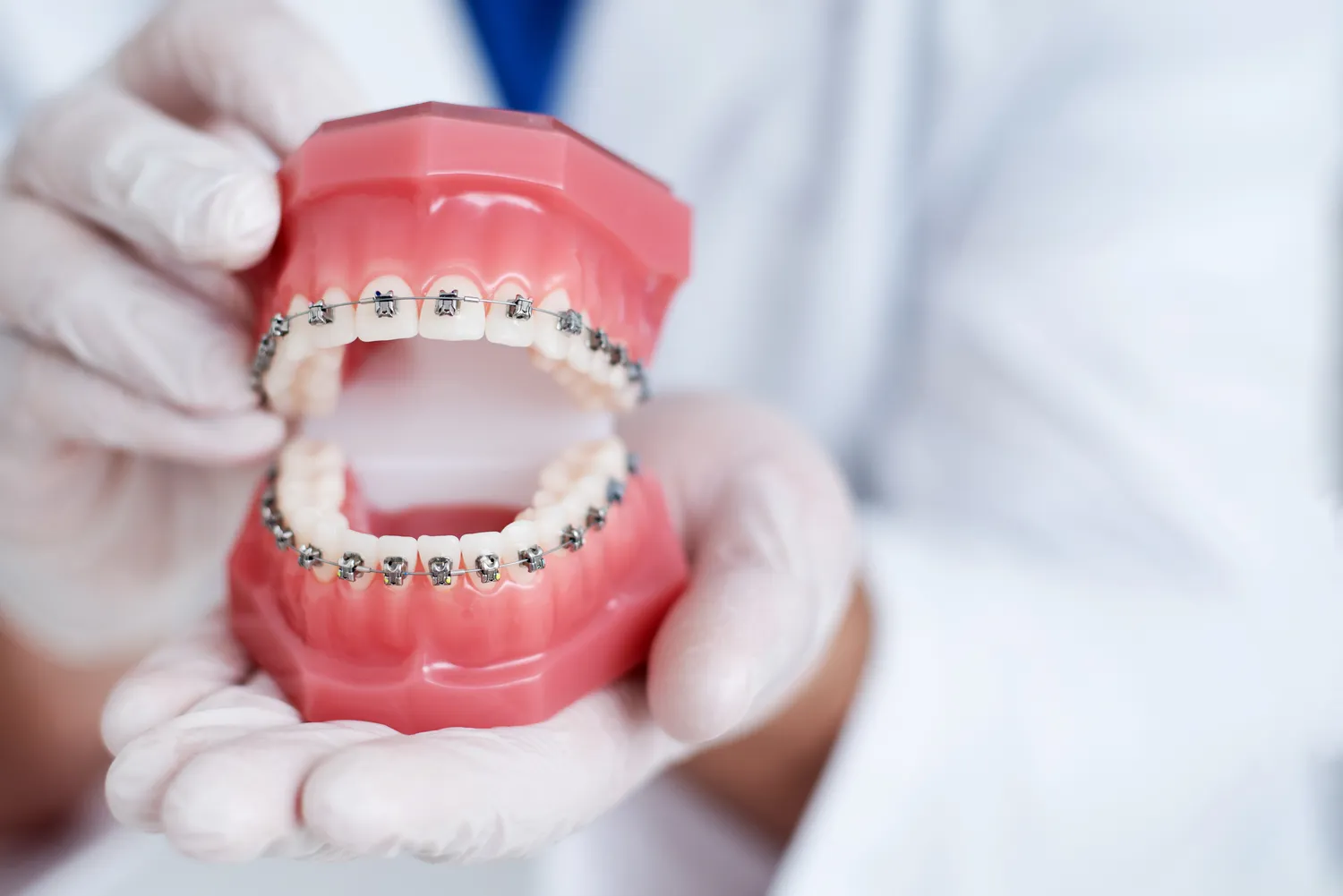 Co trzeba wiedzieć o implantach zębowych?