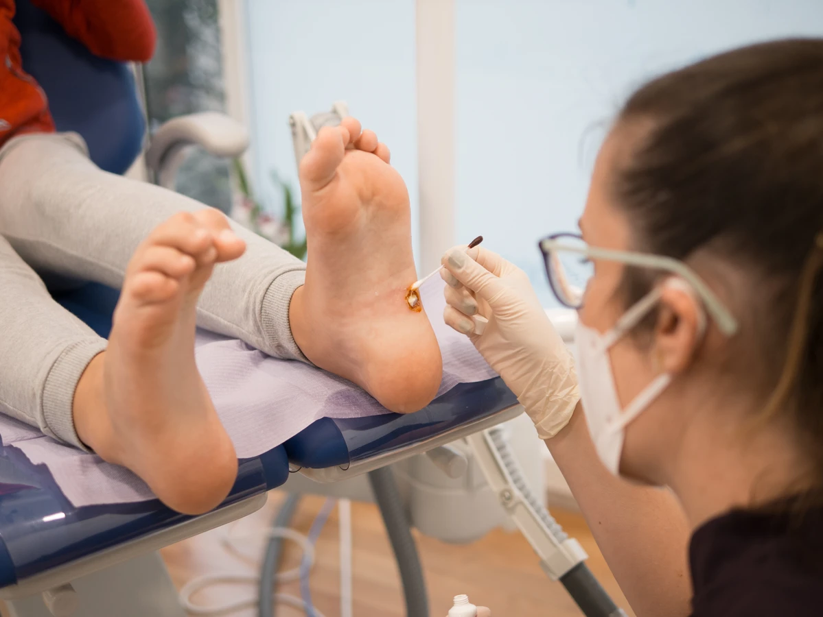 Pedicure leczniczy - co o nim wiedzieć warto?
