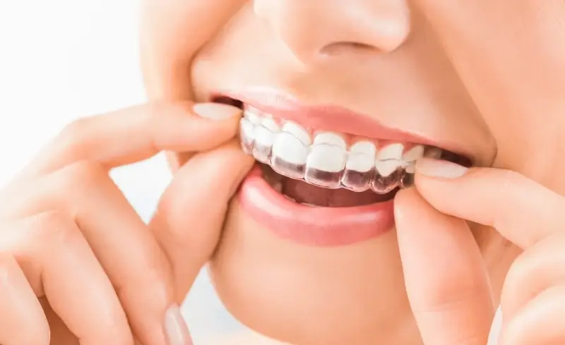 Stomatolog wykona odbudowę uzębienia przy pomocy implantów zębowych
