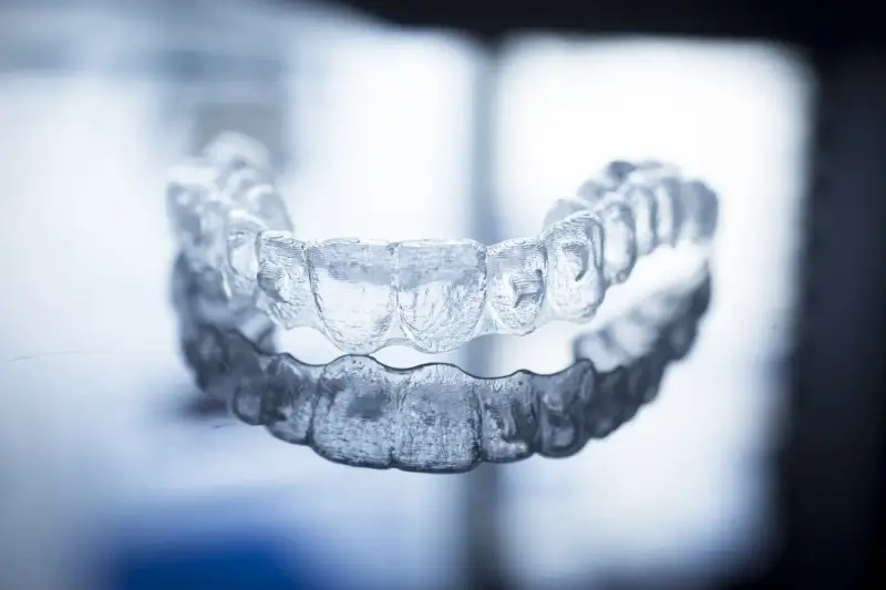 Ile kosztuje Invisalign w Polsce?