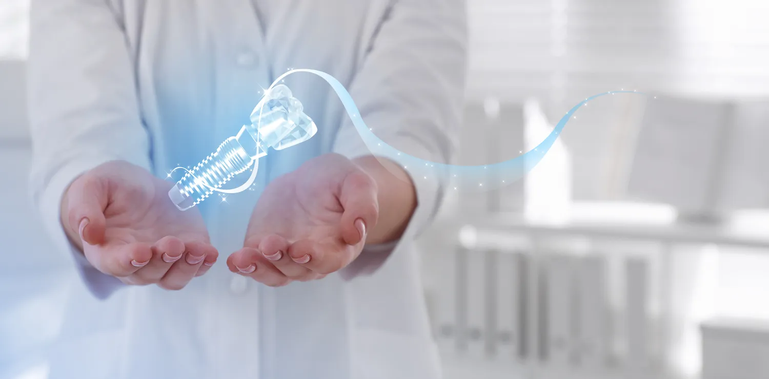 Ile kosztują implanty całej szczęki?