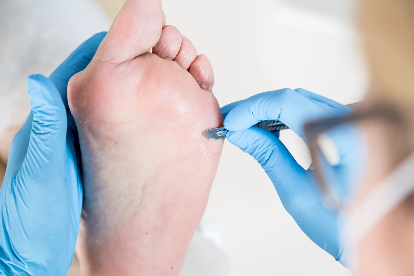 Podologia dla laików - w czym pomoże ci podolog?